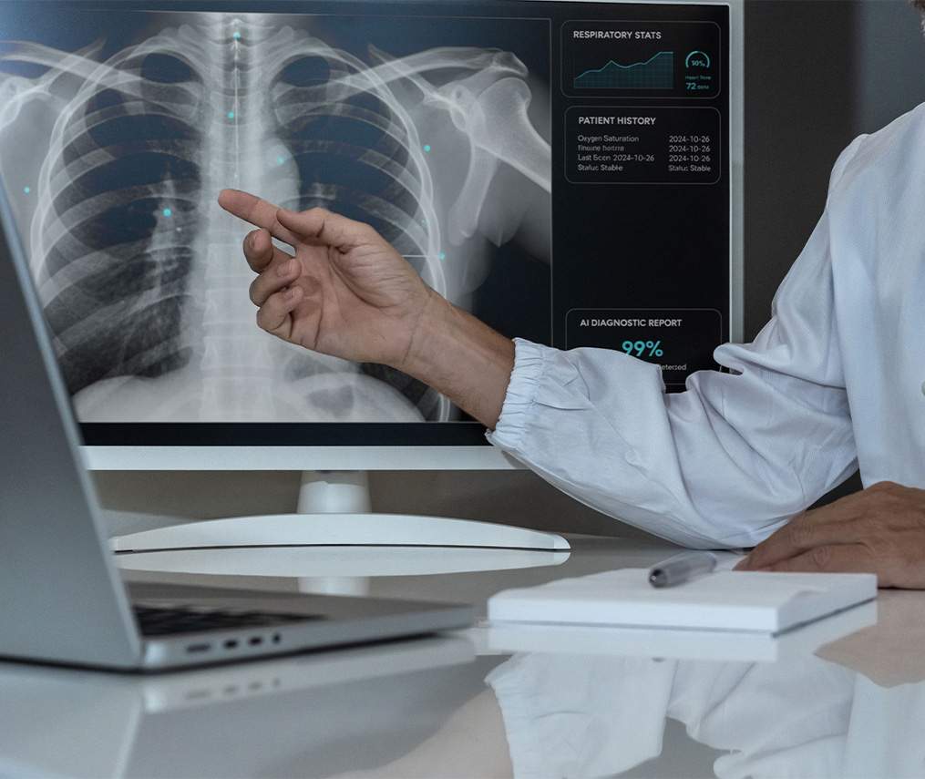 examining a chest xray